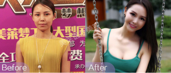 直到遇到了杭州美莱，当了30年“太平公主”的我变成了万人迷