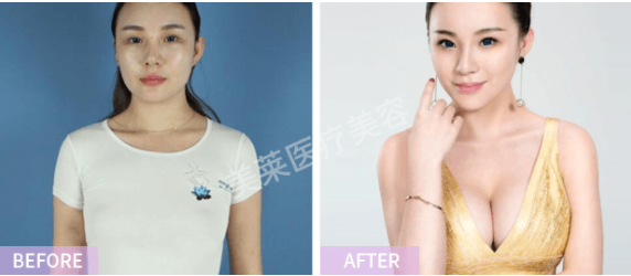直到遇到了杭州美莱，当了30年“太平公主”的我变成了万人迷