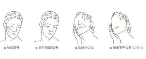 厦门欧菲整形医院：法令纹4D微雕，较适合现代人的美容方式