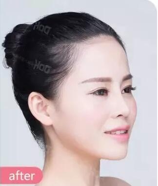 如何预约鼻修复专家周珂?11月23-26日周珂院长在成都铜雀台医院
