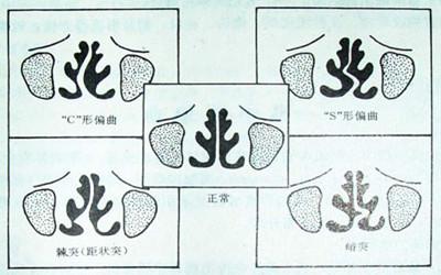 上海某医院美容整形科隆鼻手术技术怎么样？费用多少？