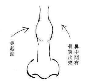 临汾硅胶鼻综合的费用受那些因素的影响