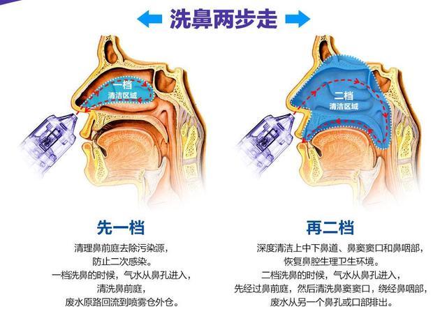 北京齐彦文医生隆鼻技术怎么样？隆鼻费用多少？效果好不好？