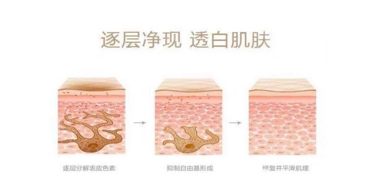 彩光嫩肤价格曝光：让你的肌肤焕发新生要费用多少？