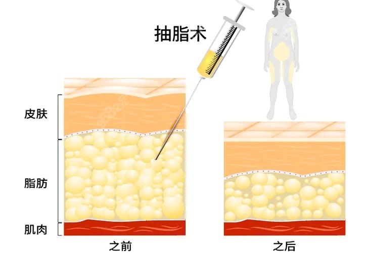 广西整形医院技术怎么样？手术费用及医生团队实力详解