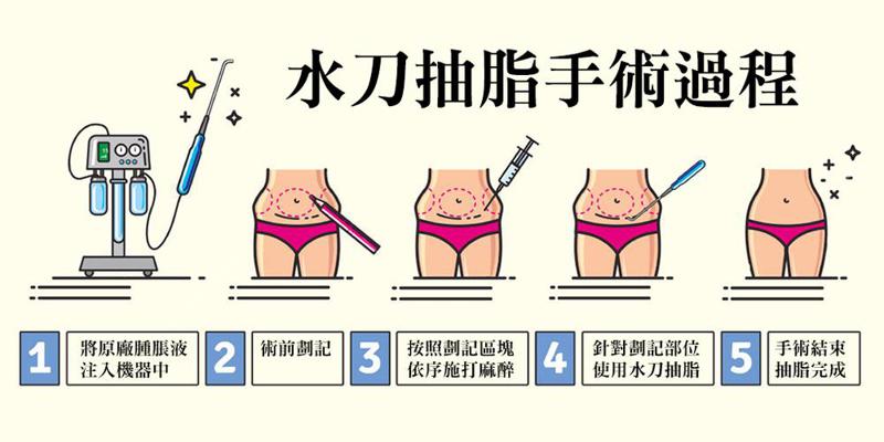 武汉抽脂技术好的医院排名（武汉抽脂医院排名更新）