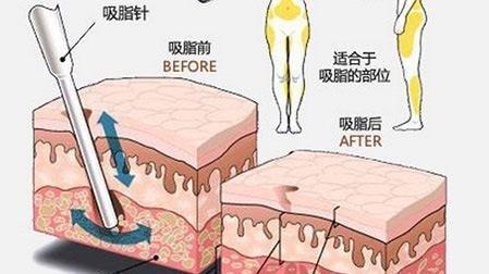 成都蜀尚蓉雅美容整形医院价格费用多少？项目全解析