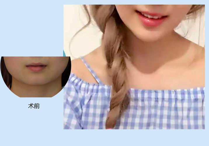 成都汉密尔顿整形美容医院价格费用多少？整形项目全解析