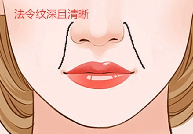 玻尿酸去法令纹价格费用多少？解析影响因素
