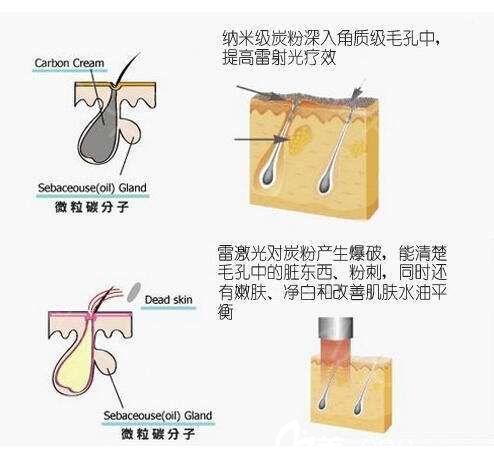 成都做黑脸娃娃价格费用多少？解析影响因素