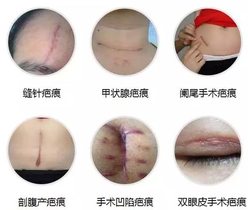 西安美好美容医院整形价格多少钱？详细价格表来啦！