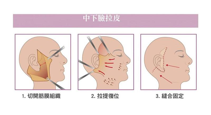 娄底希美整形医院热门项目价格费用多少？详细解析！