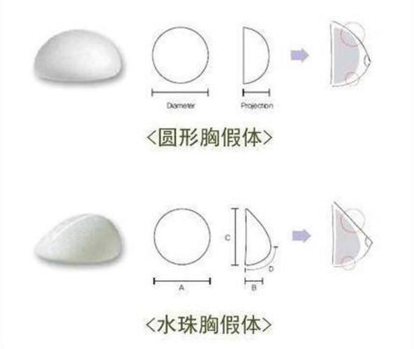 抚顺曼托水滴型假体隆胸的价格为什么比较贵呢