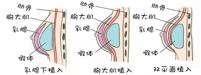 南京明水整形美容医院的医生阵容及手术案例展示