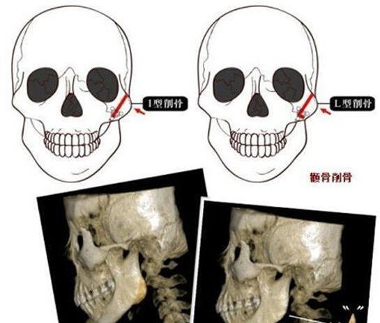 深圳美莱医疗美容医院价格费用多少？曝光一览！
