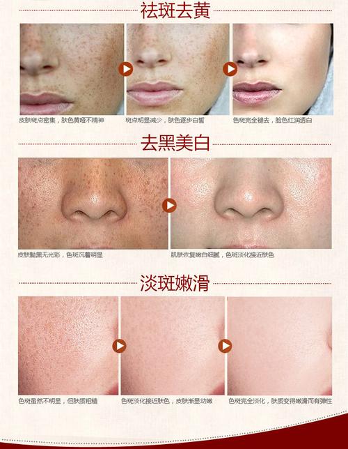 吉林治疗脱发较有名的医院(吉林市治脱发哪家医院好)