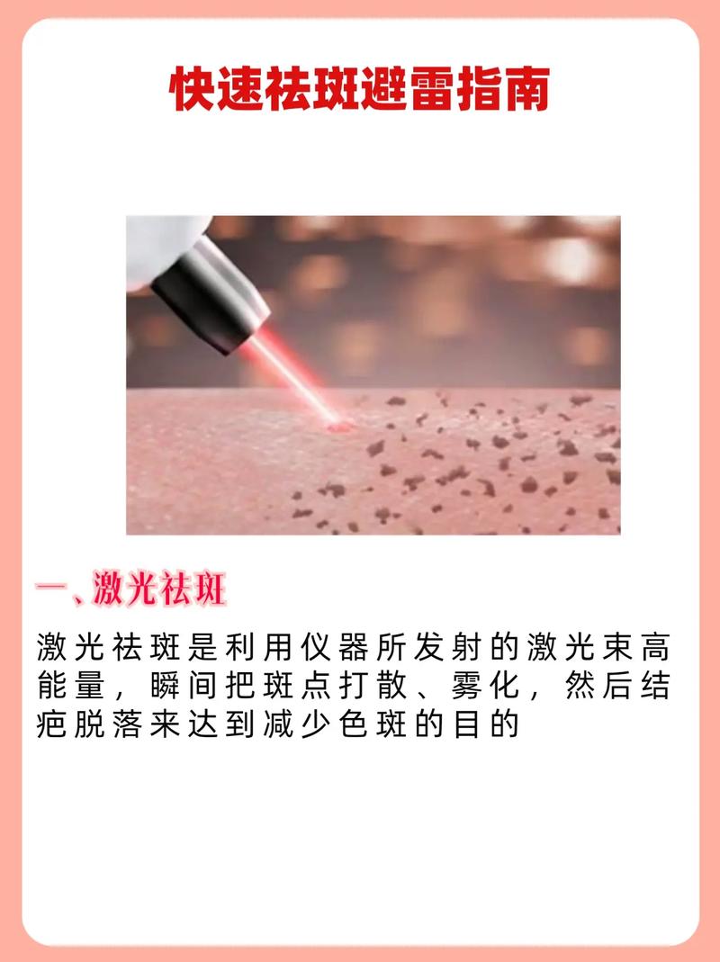 柳州市柳铁中心医院烧伤整形外科评价，激光祛斑效果与费用解析