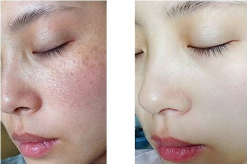 [在线预览]南昌二附院整形美容科价目表，新优惠！附双眼皮、祛斑案例