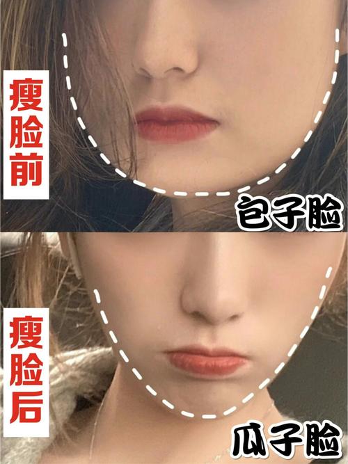 注射瘦脸价格费用多少？解析影响因素