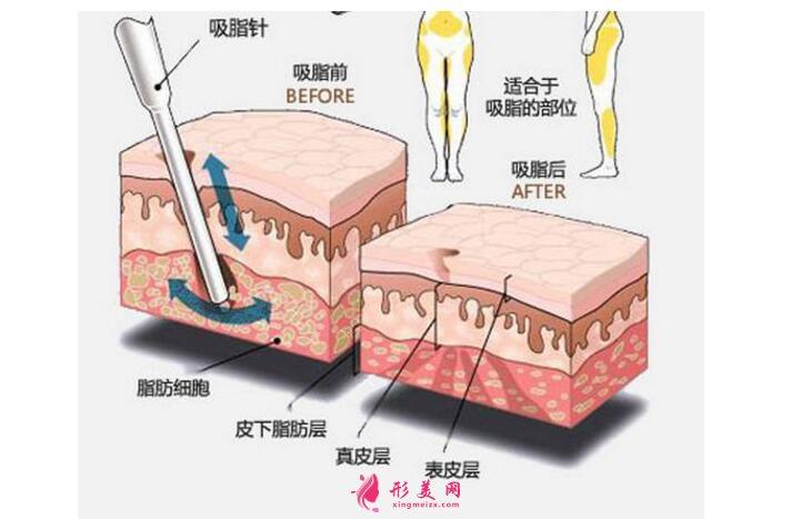 南阳市第八人民医院整形科怎么样？多少钱？费用多少？好不好？