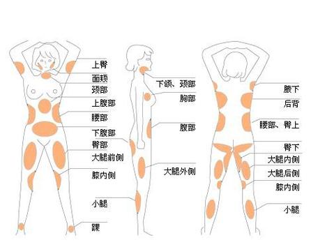福州悦己整形医院：吸脂塑形与隆鼻手术技术怎么样？