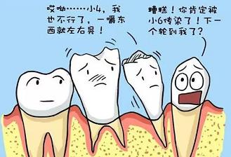 烤瓷牙种类大曝光及价格费用多少一览表