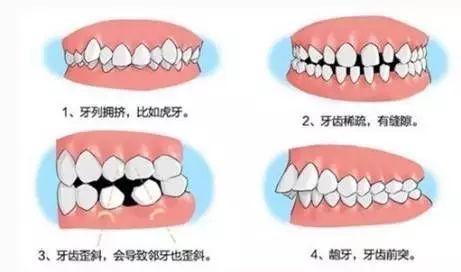 邵阳嘉贝美口腔门诊部价目表，洁牙经历及效果图