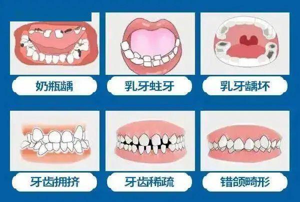 滁州二院牙齿矫正价目表，附专家推荐
