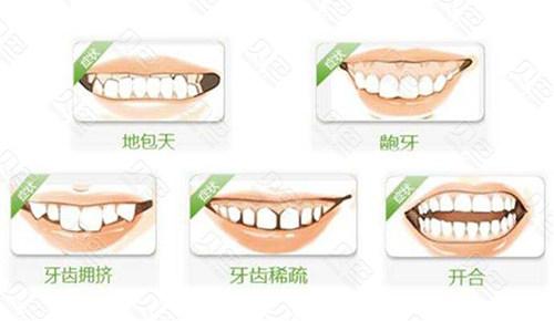 北京金圣口腔怎么样，附牙齿矫正过程图
