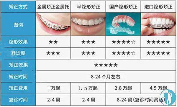 九江口腔医院收费标准，嘴凸牙齿矫正案例