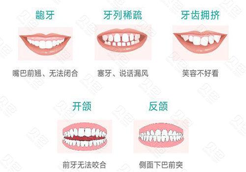 易美齐隐形牙套多少钱[易美齐隐形牙套多少钱一副]