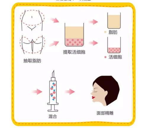 北京东方和谐自体脂肪填充价格大曝光，