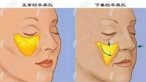 清远养和整形医院价格费用多少？详细项目费用一览