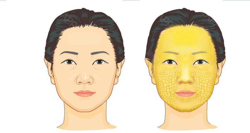 哈尔滨奥康医疗美容整形价格费用多少？详细项目费用曝光