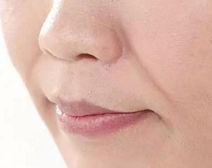 哈医大一院整形美容科自体脂肪隆胸技术怎么样？费用多少？