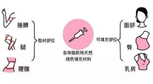 大连自体脂肪丰胸价格费用多少？解析影响因素