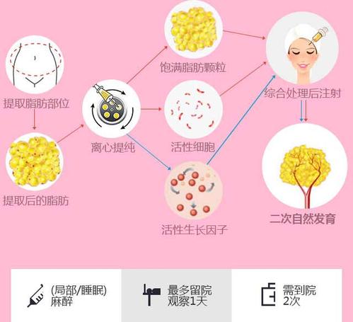 宁波自体脂肪丰苹果肌医院哪里好,丰苹果肌医院：塑造自然美颜的秘密武器