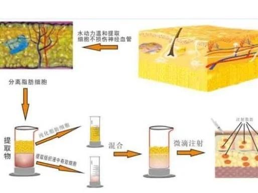 成都素美天姿医院整形价格费用多少？解析及预约指南