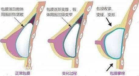倪锋医生的整形技术与费用详解