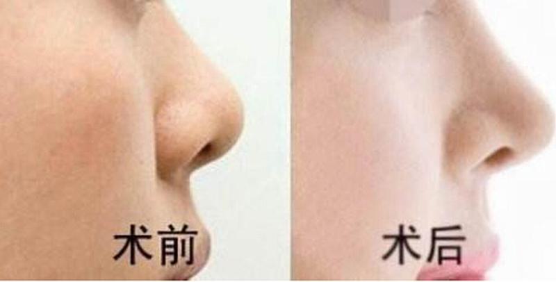 运城臻美整形医院价目表大曝光，高性价比选择哪家强？