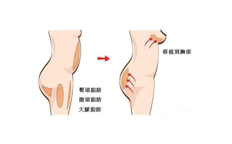 郑州出水芙蓉整形医院价格费用多少？详细项目费用一览！