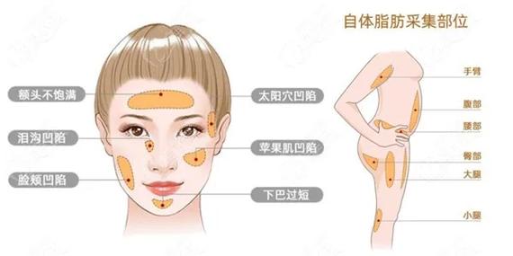 自体脂肪胸部填充案例及整形项目价格全曝光