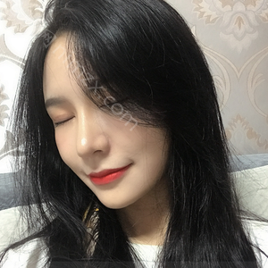 福州星龄整形张蕾医生做血管瘤 靠谱吗？