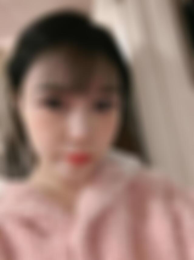 解放军较好〇五医院整形科陶琳医生做酒窝成形术怎么样？