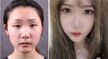 「侣同帅」上海华美侣同帅口碑怎么样-简介-擅长-评价-案例
