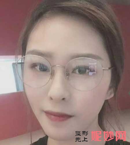 重庆华美整形美容医院李英整形技术怎么样?坐诊时间_注射瘦脸真实案例反馈