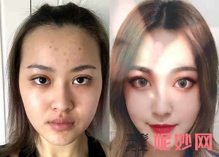 北医三院整形外科潘柏林医生好不好?简介,擅长项目,门诊时间,案例