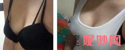 北京协和整形医院宋可新怎么样?个人简介_失败案例_价格_出诊时间