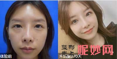 北京协和医院整形外科黄久佐技术好不好?会失败吗?擅长项目,案例,出诊时间