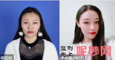 北京协和黄渭清医生技术好不好?擅长项目_口碑_出诊时间_案例